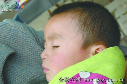 幼兒園女老師扇兩歲半幼兒耳光稱(chēng)心情不好(圖)